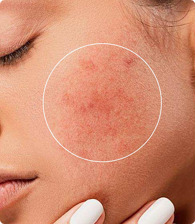 FOR DRY SKIN